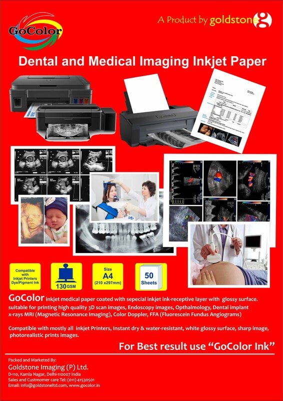 Inkjet Paper for Dental & Medical Imaging - 3D Scan, Endoscory Images, Dental Implant, X Ray MRI, Color Droppler, FFA etc A4 Size 130 GSM 50 Sheet Pack Inkjet Paper for Dental & Medical Imaging - 3D Scan, Endoscory Images, Dental Implant, X Ray MRI, Color Droppler, FFA etc A4 Size 130 GSM 50 Sheet Pack